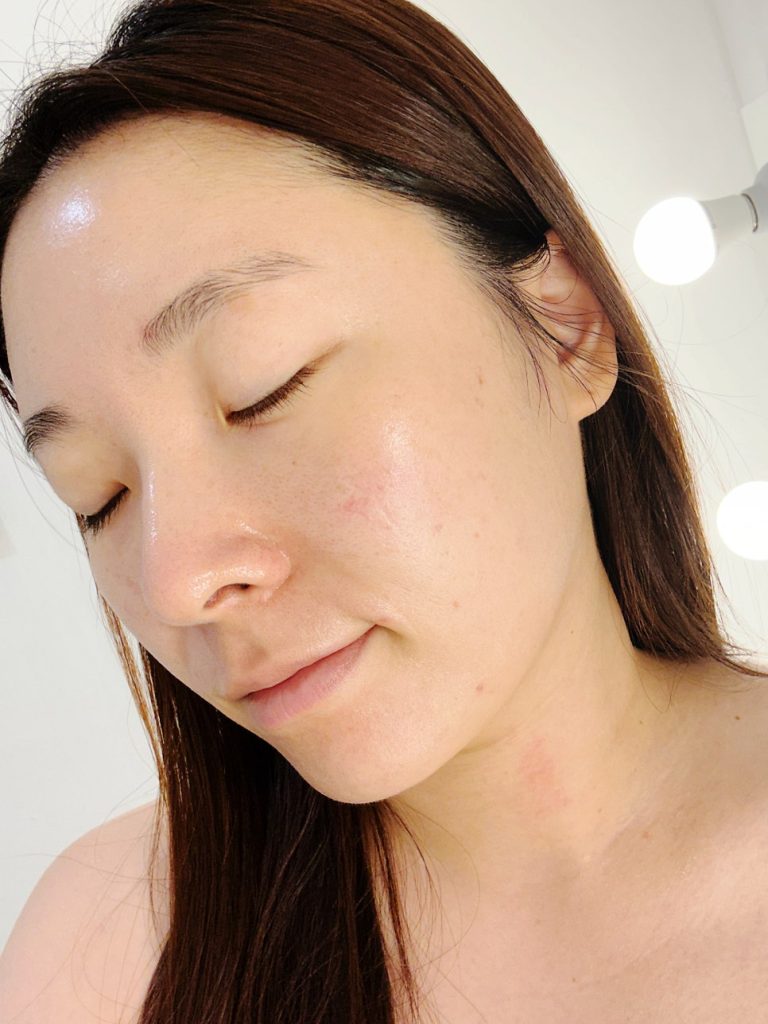 Glowing skin right after the hydration facial
