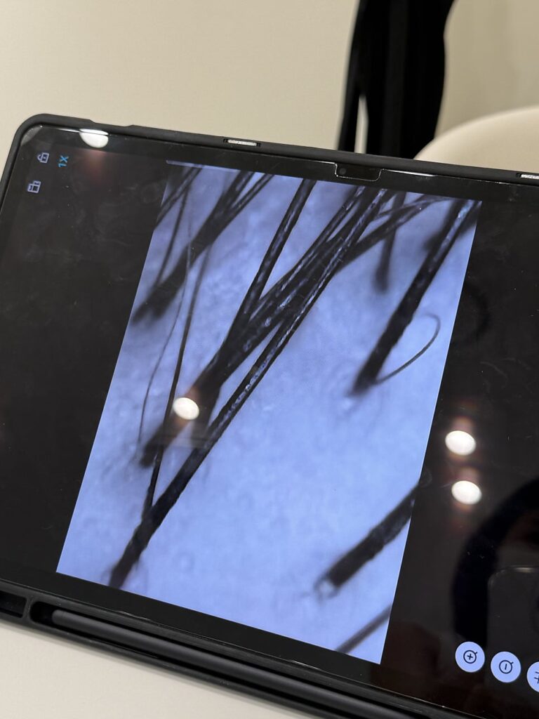 Scalp scan after the treatment with clearer pores